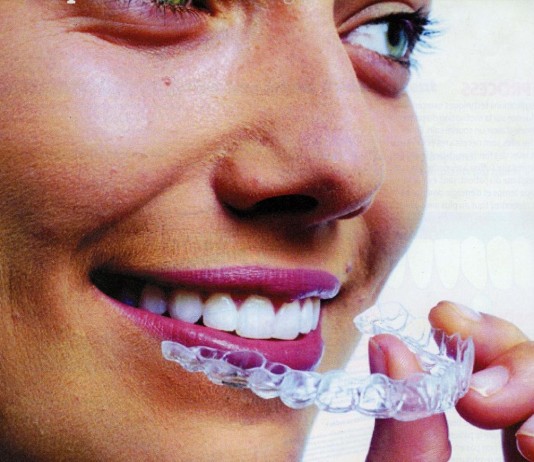 Quels appareils dentaires adulte existent pour replacer ses dents ?